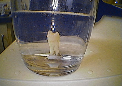 Tooth an a glass of water